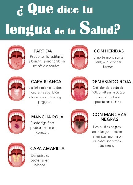 Qué dice tu lengua de tu salud. Tipos de lenguas
